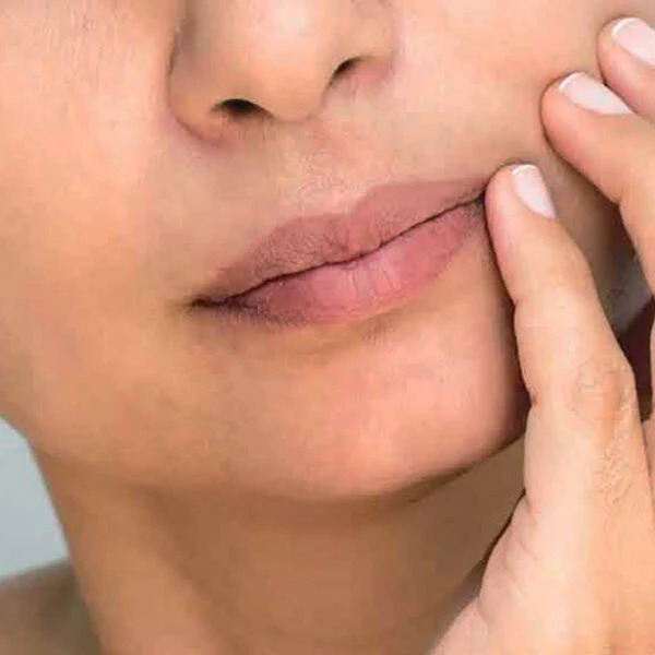 Dull Skin